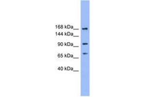 Image no. 1 for anti-ADAM Metallopeptidase with Thrombospondin Type 1 Motif, 19 (ADAMTS19) (N-Term) antibody (ABIN6746174) (ADAMTS19 Antikörper  (N-Term))