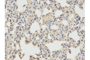Immunohistochemistry (IHC) image for anti-Neural Wiskott-Aldrich syndrome protein (WASL) antibody (ABIN1875345) (Neural Wiskott-Aldrich syndrome protein (WASL) Antikörper)