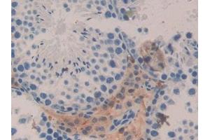 Immunohistochemistry (IHC) image for anti-Interleukin 5 Receptor, alpha (IL5RA) (AA 41-203) antibody (ABIN7433729)