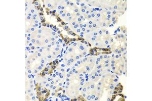 Immunohistochemistry of paraffin-embedded mouse kidney using ENDOG antibody. (Endonuclease G Antikörper)