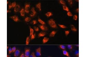Immunofluorescence analysis of HeLa cells using C1 Inactivator Polyclonal Antibody at dilution of 1:100. (SERPING1 Antikörper)