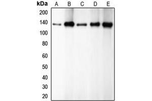 Western Blotting (WB) image for anti-Cadherin 1, Type 1, E-Cadherin (Epithelial) (CDH1) (C-Term) antibody (ABIN7295214)