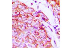 Immunohistochemistry (IHC) image for anti-VEGF Receptor 2 (VEGFR2) (C-Term), (pTyr1175) antibody (ABIN7300910)