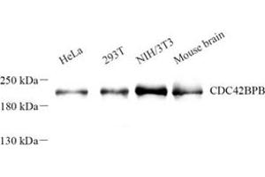 Western blot analysis of Cdc42bpb (ABIN7073411) at dilution of 1: 500 (CDC42BPB Antikörper)