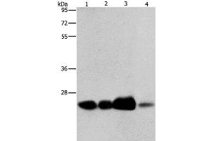Western Blot analysis of 293T cell and Human fetal liver tissue, Human cervical cancer and fetal muscle tissue using ARFRP1 Polyclonal Antibody at dilution of 1:800 (ARFRP1 Antikörper)