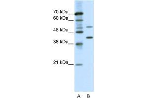 WB Suggested Anti-REXO4 Antibody Titration:  0. (REXO4 Antikörper  (C-Term))