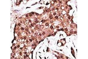 Immunohistochemistry (IHC) image for anti-ATG5 Autophagy Related 5 (ATG5) (AA 1-30) antibody (ABIN3030038)