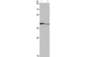 Gel: 8 % SDS-PAGE, Lysate: 40 μg, Lane 1-2: Mouse small intestine tissue, Mouse skin tissue, Primary antibody: ABIN7129190(DEGS1 Antibody) at dilution 1/450, Secondary antibody: Goat anti rabbit IgG at 1/8000 dilution, Exposure time: 5 minutes (DEGS1 Antikörper)