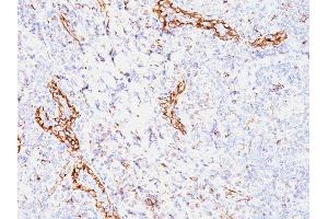 Immunohistochemistry (IHC) image for anti-Vascular Endothelial Growth Factor A (VEGFA) antibody (ABIN6940867)