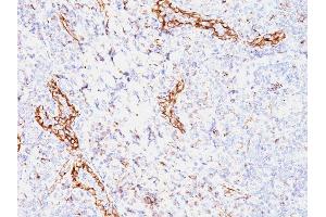 Formalin-fixed, paraffin-embedded human Tonsil stained with VEGF Mouse Monoclonal Antibody (VEGF/1063). (VEGFA Antikörper)