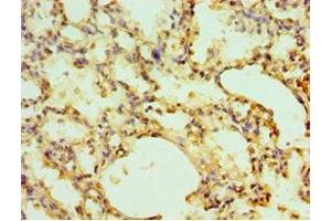 Immunohistochemistry of paraffin-embedded human lung tissue using ABIN7151442 at dilution of 1:100 (EGLN1 Antikörper  (AA 301-426))
