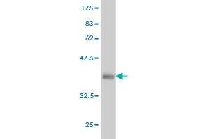 Western Blot detection against Immunogen (36. (IRAK2 Antikörper  (AA 111-210))