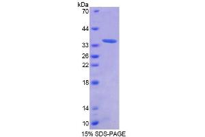 SDS-PAGE analysis of Human AZIN1 Protein.