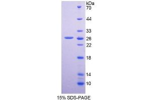 SDS-PAGE analysis of Human DPP6 Protein. (DPP6 Protein)