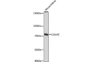 Western blot analysis of extracts of Mouse kidney using C10orf2 Polyclonal Antibody at dilution of 1:1000. (C10orf2 Antikörper)