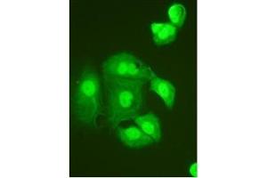 Immunocytochemistry on HeLa Cell