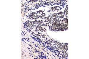 IHC analysis of RPA70 using anti-RPA70 antibody (ABIN6719369).
