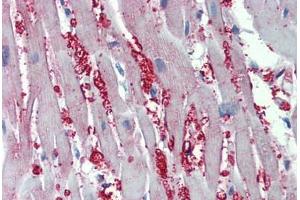 Human Heart: Formalin-Fixed, Paraffin-Embedded (FFPE) (alpha 1 Adrenergic Receptor Antikörper  (AA 206-270))