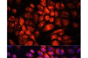 Immunofluorescence analysis of HeLa cells using UCP3 Polyclonal Antibody at dilution of 1:100. (UCP3 Antikörper)