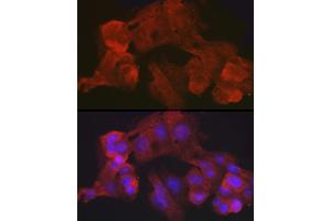 Immunofluorescence analysis of HepG2 cells using Villin1 Rabbit mAb (ABIN7271323) at dilution of 1:100 (40x lens). (Villin 1 Antikörper)