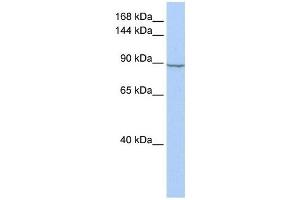 Hexokinase 2 antibody used at 1 ug/ml to detect target protein.