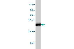 Western Blotting (WB) image for anti-ATP-Binding Cassette, Sub-Family C (CFTR/MRP), Member 6 (ABCC6) (AA 831-930) antibody (ABIN559915)