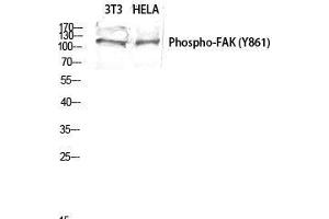 Western Blot (WB) analysis of 3T3 HeLa lysis using Phospho-FAK (Y861) antibody. (FAK Antikörper  (pTyr861))
