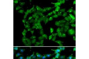 Immunofluorescence analysis of U2OS cells using PRKAB2 Polyclonal Antibody (PRKAB2 Antikörper)