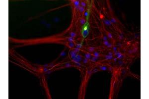 Mixed neuron/glia cultures from newborn rat brain stained with ABIN1580456 antibody to peripherin (green) and rabbit polyclonal antibody to NF-L RPCA-NF-L (red channel). (Peripherin Antikörper)