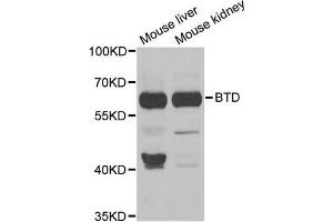 Western Blotting (WB) image for anti-Biotinidase (BTD) antibody (ABIN1980300) (BTD Antikörper)