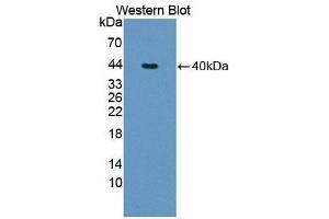 Western blot analysis of the recombinant protein. (TNNT1 Antikörper  (AA 1-261))