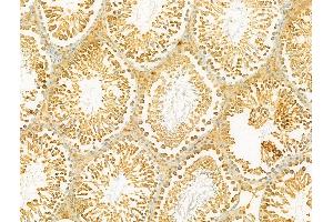 ABIN6264964 and ABIN6273072 at 1/100 staining Rat testis tissue by IHC-P. (SECISBP2 Antikörper  (Internal Region))