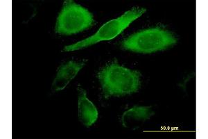 Immunofluorescence of monoclonal antibody to CDK4 on HeLa cell. (CDK4 Antikörper  (AA 211-303))