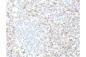 Immunohistochemistry (IHC) image for anti-Interleukin 7 Receptor (IL7R) (AA 21-236) antibody (ABIN7453897) (Rekombinanter IL7R Antikörper  (AA 21-236))
