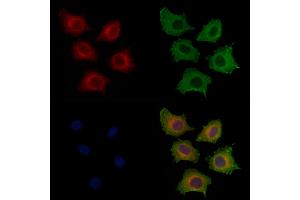 ABIN6256799 and ABIN6267420 staining HepG2 cells(4h of LPS treatment) by IF/ICC.