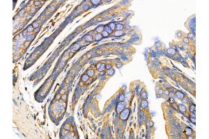 ABIN6258512 and ABIN6274729 at 1/100 staining Rat stomach tissue by IHC-P.