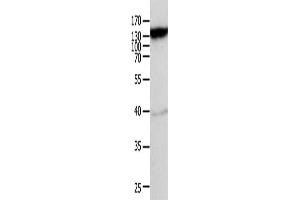 Gel: 10 % SDS-PAGE, Lysate: 40 μg, Lane: Mouse heart tissue, Primary antibody: ABIN7189591(ABCC5 Antibody) at dilution 1/950, Secondary antibody: Goat anti rabbit IgG at 1/8000 dilution, Exposure time: 10 minutes (ABCC5 Antikörper)