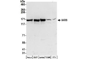 anti-Isoleucyl-tRNA Synthetase (IARS) (AA 1212-1262) antibody
