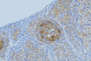 Immunohistochemistry (IHC) image for anti-Chemokine (C-X-C Motif) Ligand 1 (Melanoma Growth Stimulating Activity, Alpha) (CXCL1) (Internal Region) antibody (ABIN6262095)