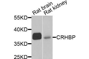 Western blot analysis of extracts of rat brain and rat kidney cells, using CRHBP antibody. (CRHBP Antikörper)