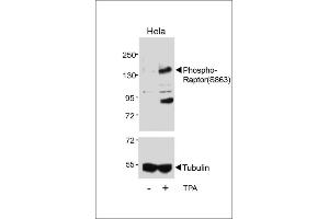 RAPTOR Antikörper  (pSer863)