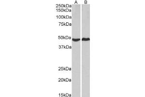 ABIN5539751 (2µg/ml) staining of HeLa (A) and MCF7 (B) lysates (35µg protein in RIPA buffer).