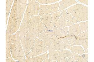 ABIN7094495 and ABIN7098544 at 1/100 staining Rat muscle tissue by IHC-P.