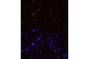 Immunofluorescence analysis of THP-1 cells using CD86 Polyclonal Antibody (ABIN7266226) at dilution of 1:100 (40x lens). (CD86 Antikörper)
