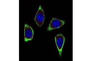 Confocal immunofluorescent analysis of RET Antibody (Ascites) ABIN659065 with MDA-M cell followed by Alexa Fluor® 488-conjugated goat anti-mouse lgG (green). (Ret Proto-Oncogene Antikörper)
