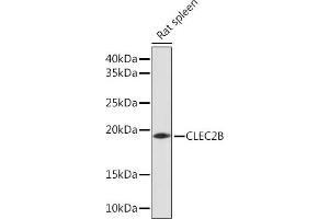 Western blot analysis of extracts of Rat spleen, using CLEC2B Rabbit pAb (ABIN7265981) at 1:1000 dilution. (CLEC2B Antikörper)