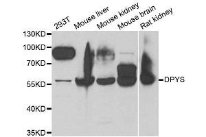 Western blot analysis of extracts of various cell lines, using DPYS antibody. (DPYS Antikörper)
