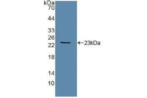Western blot analysis of recombinant Human Tie2. (TEK Antikörper  (AA 286-465))