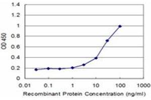 Detection limit for recombinant GST tagged STK24 is approximately 1ng/ml as a capture antibody. (STK24 Antikörper  (AA 1-431))