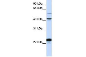 Western Blot showing EVX1 antibody used at a concentration of 1-2 ug/ml to detect its target protein.